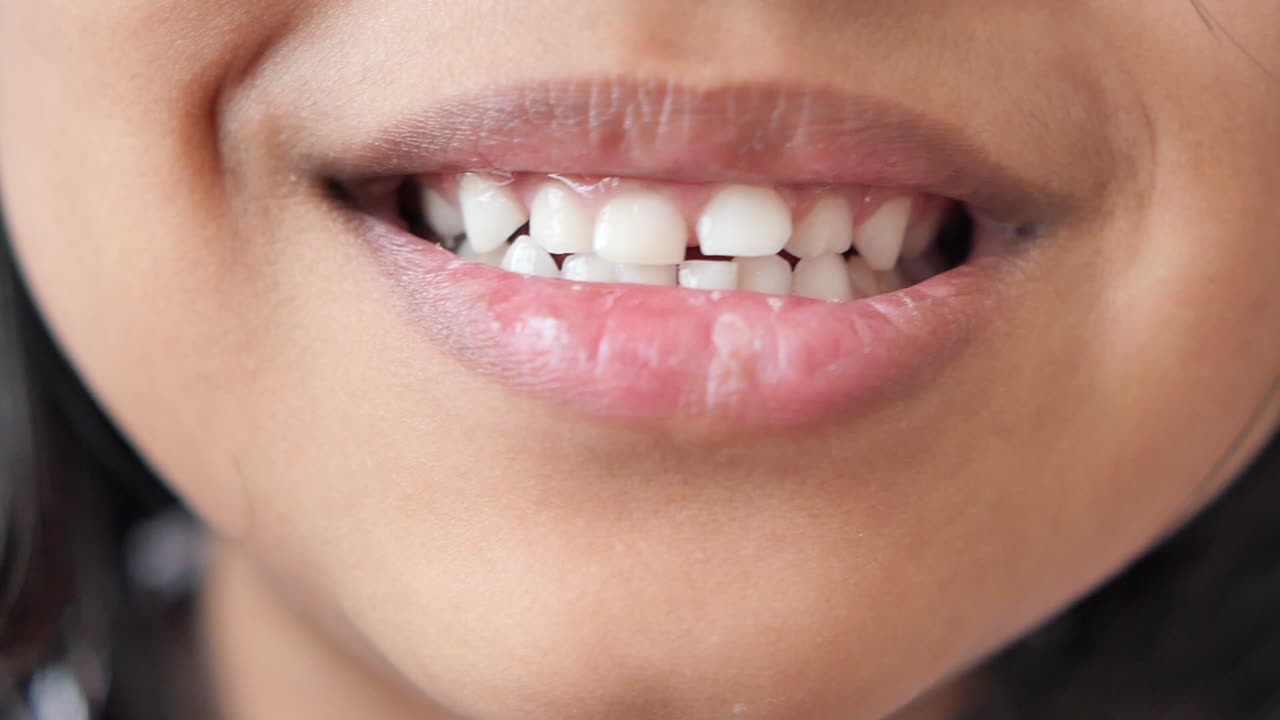 primer plano de la boca y los dientes sonrientes de un niño