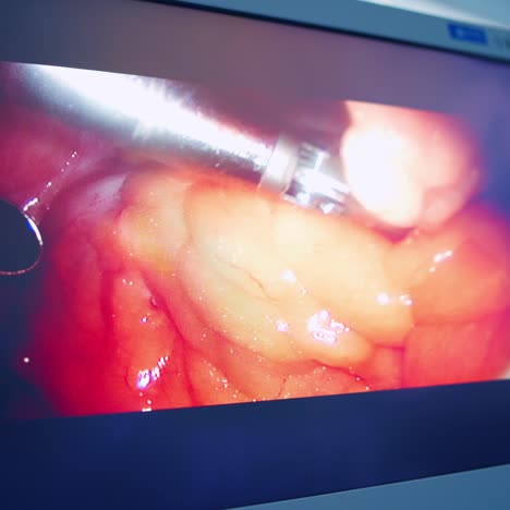 modern surgical system. medical robot. minimally invasive robotic surgery.