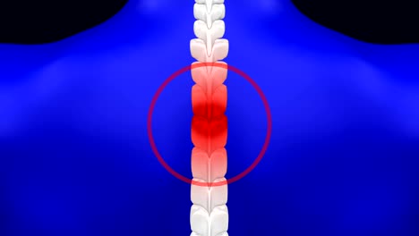 middle back pain.