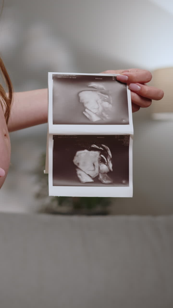 Donna che tiene in mano due foto di un'ecografia che mostrano lo sviluppo del feto, catturando l'attesa e la gioia