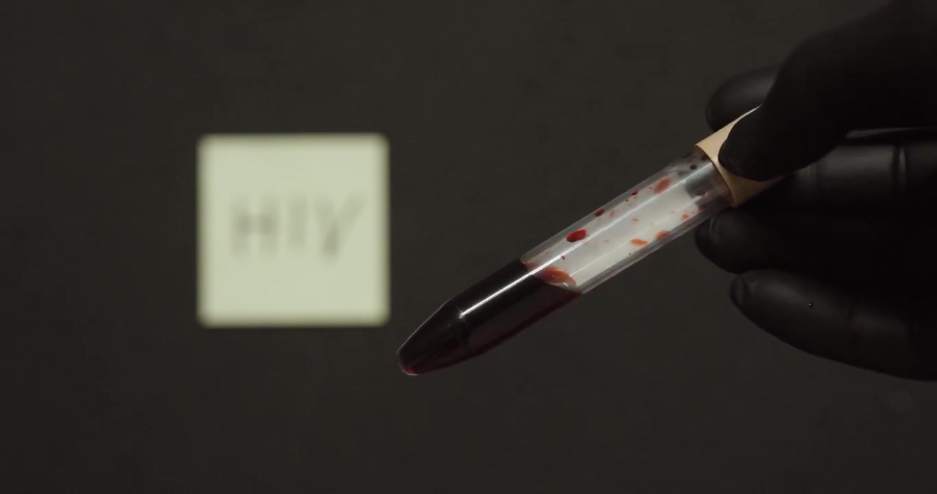 L'attenzione si sposta da una fiala di campione di sangue a una nota etichettata "HIV", che simboleggia test medici, diagnosi e consapevolezza.