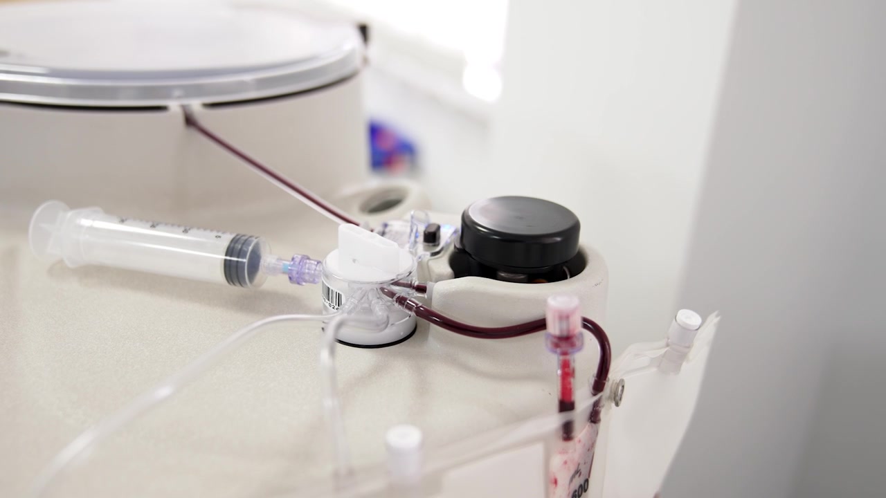 Attrezzatura per l'estrazione del plasma in funzione in ospedale. Preparazione del concentrato di PRP.