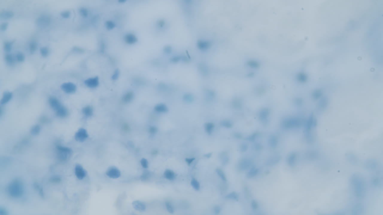 estructura del virus bajo un microscopio 3