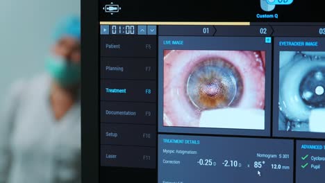 cirugía oftalmológica. vista en la pantalla del monitor médico en la sala de operaciones. lasik