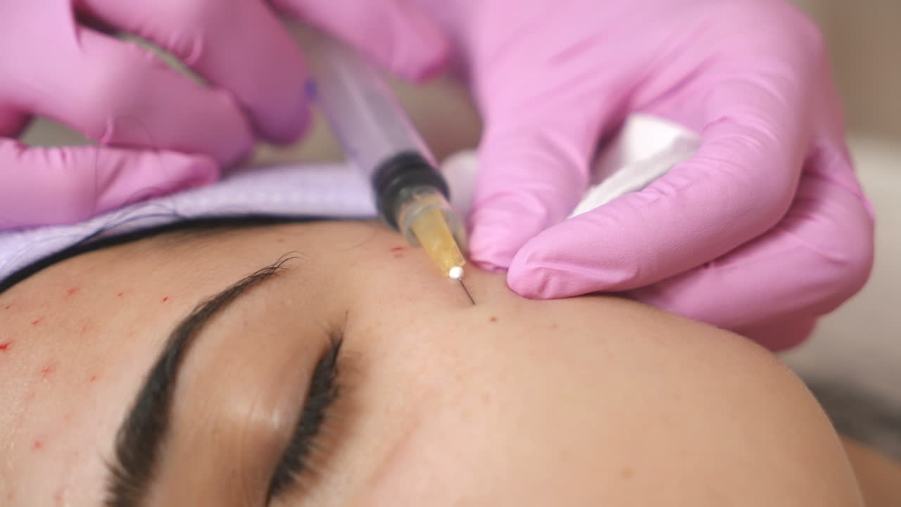 procedimiento de inyección facial