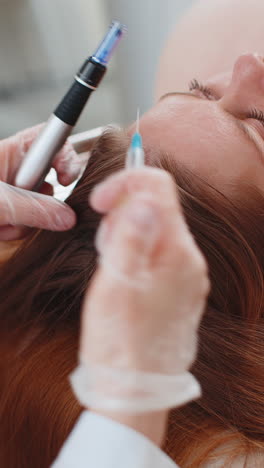 Tricólogo-Realizando-Procedimientos-De-Regeneración-Del-Cabello-Femenino,-Microagujas-Dermapen,-Inyecciones-De-Vitaminas