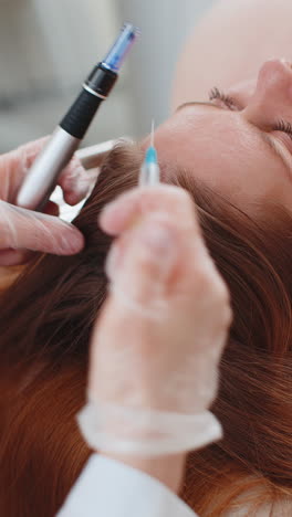 tricólogo que hace el procedimiento de regeneración del cabello de la mujer, dermapen microneedling, inyecciones de vitaminas