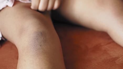 niño con una lesión en la piel de la rodilla