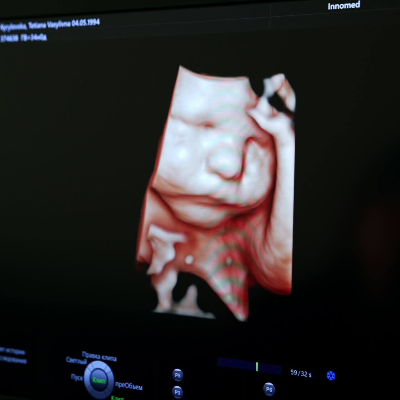 Little baby face and hands on the black screen of ultrasound equipment. Checking the child's growth and development in mom's womb