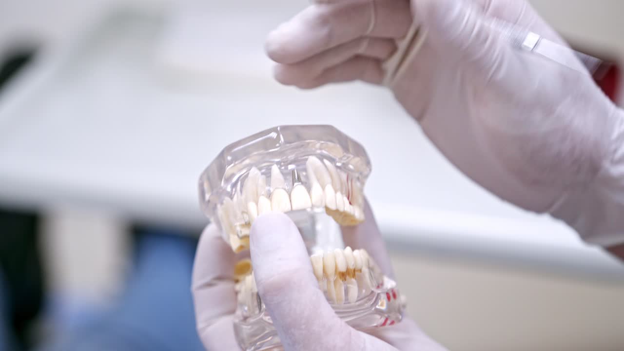 Hands holding a jaw model. Artificial teeth in stomatologist's hands. Dental implant laboratory. Progress of dental implantology. Close-up.