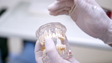 hands holding a jaw model. artificial teeth in stomatologist's hands. dental implant laboratory. progress of dental implantology. close-up.