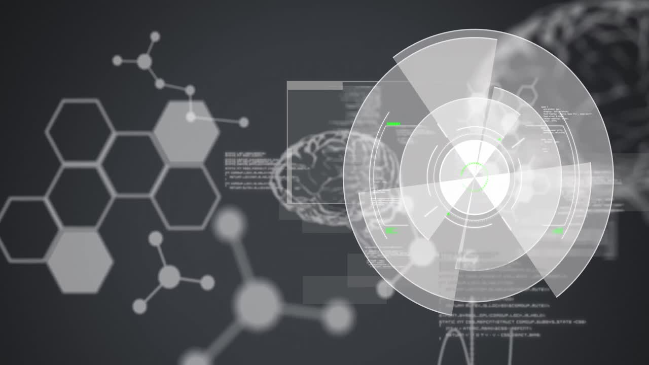 스 ⁇  스캐닝, 의료 데이터 처리 및 인간 뇌의 애니메이션