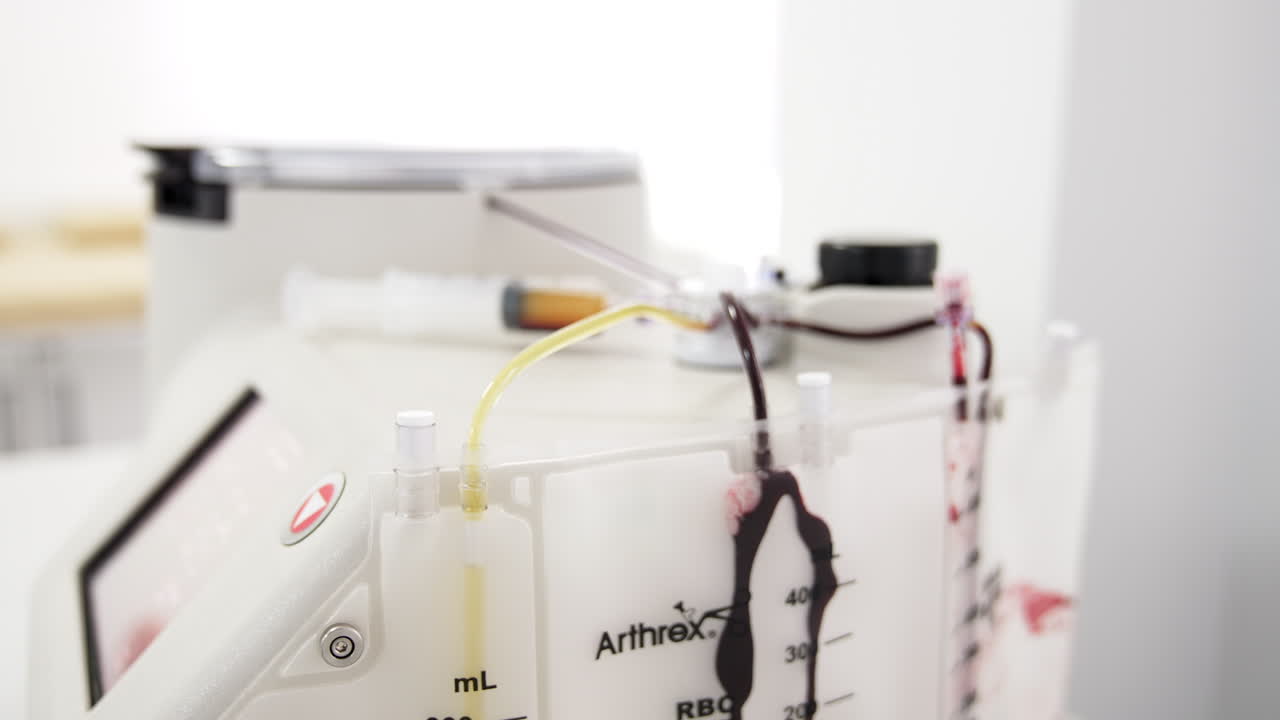 Centrifuge machine is separating plasma from blood sample. Plasma therapy in hospital. Close up.