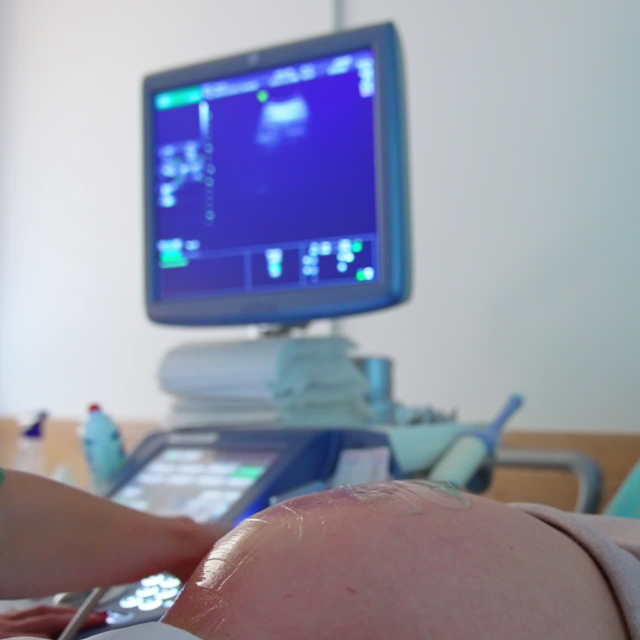Donna incinta che si sottopone a un'ecografia. Schermo blu sullo sfondo che mostra lo sviluppo del bambino