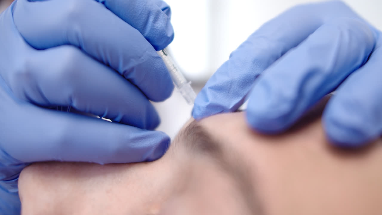 Beautiful slow motion close-up shot of a female doctor's hands injecting botox into a young patient during her beauty treatment in a well-lit dermatology clinic.