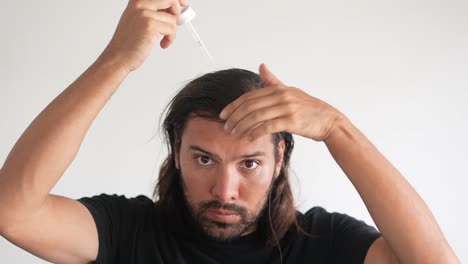 Mann,-Der-Minoxidil-Mit-Einer-Pipette-Ins-Haar-Einträgt,-Kahlheit,-Dünner-Werdendes-Haar