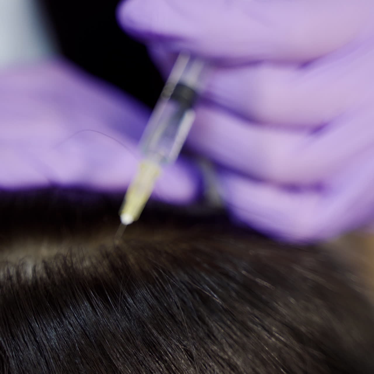 Young woman with hair problem receiving injection in clinic, close up