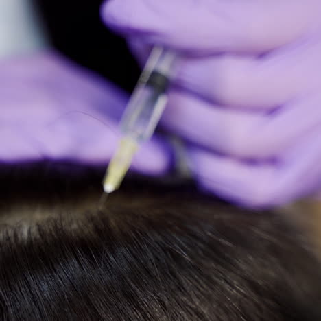 young woman with hair problem receiving injection in clinic, close up