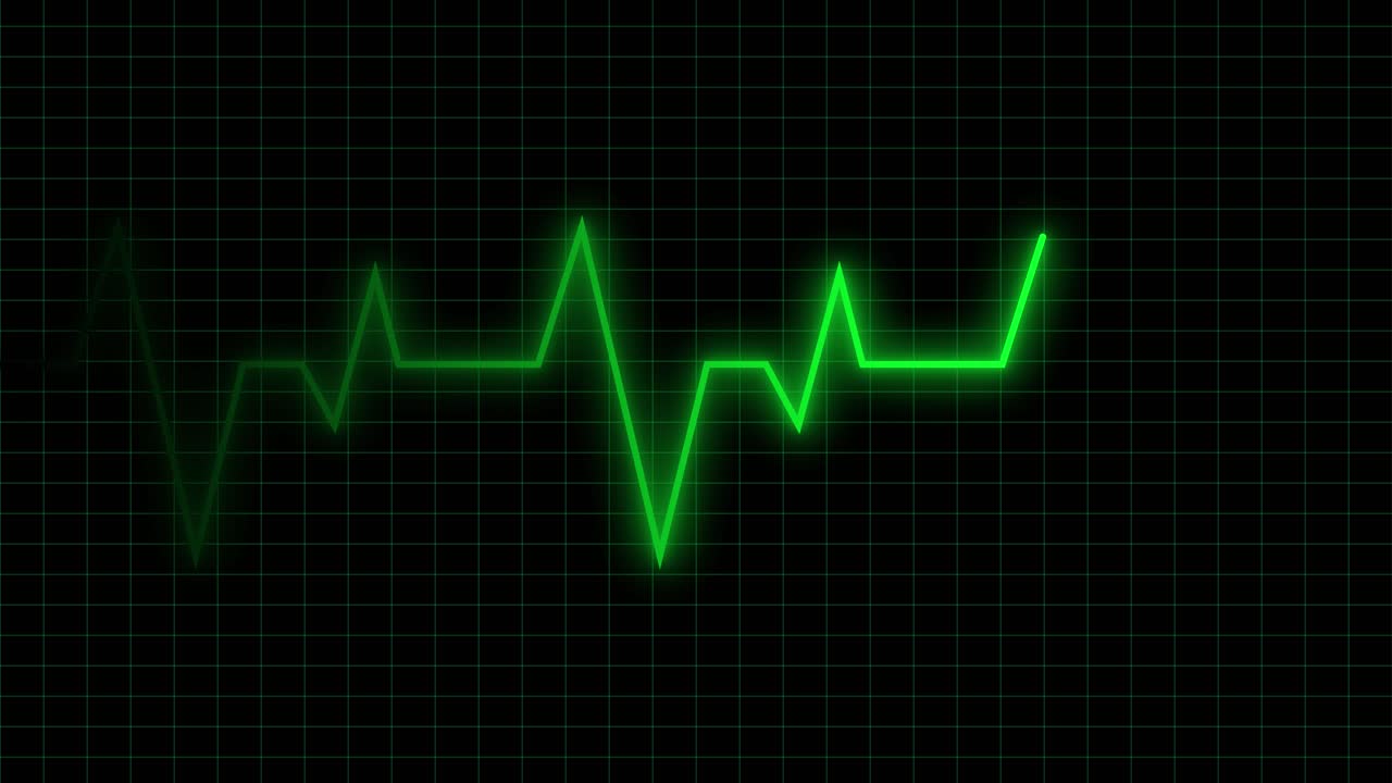 Línea de pulso de electrocardiograma digital sobre cuadrícula negra