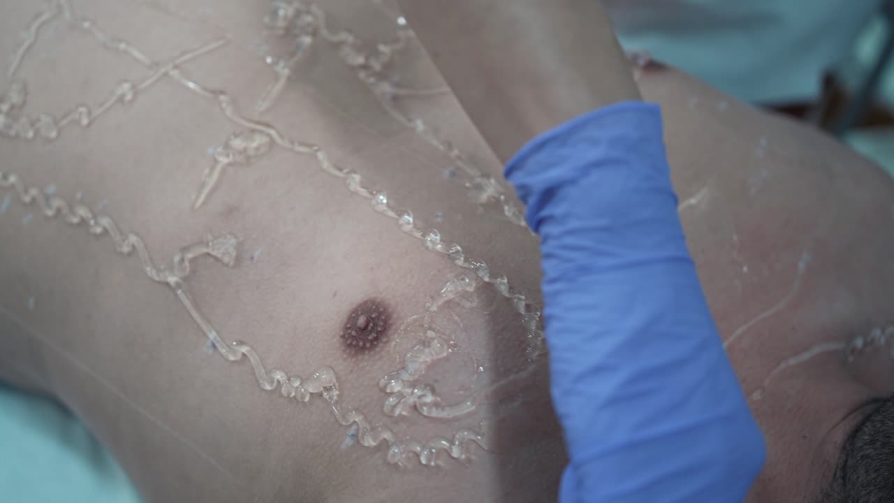 레이저 탈모용 젤 적용, 남자의 가 - 근접