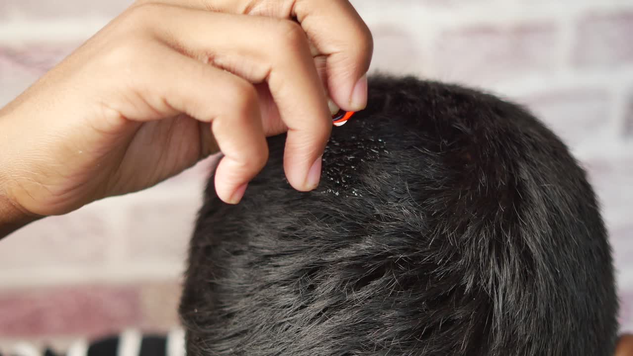 Applying Hair Oil to the Scalp