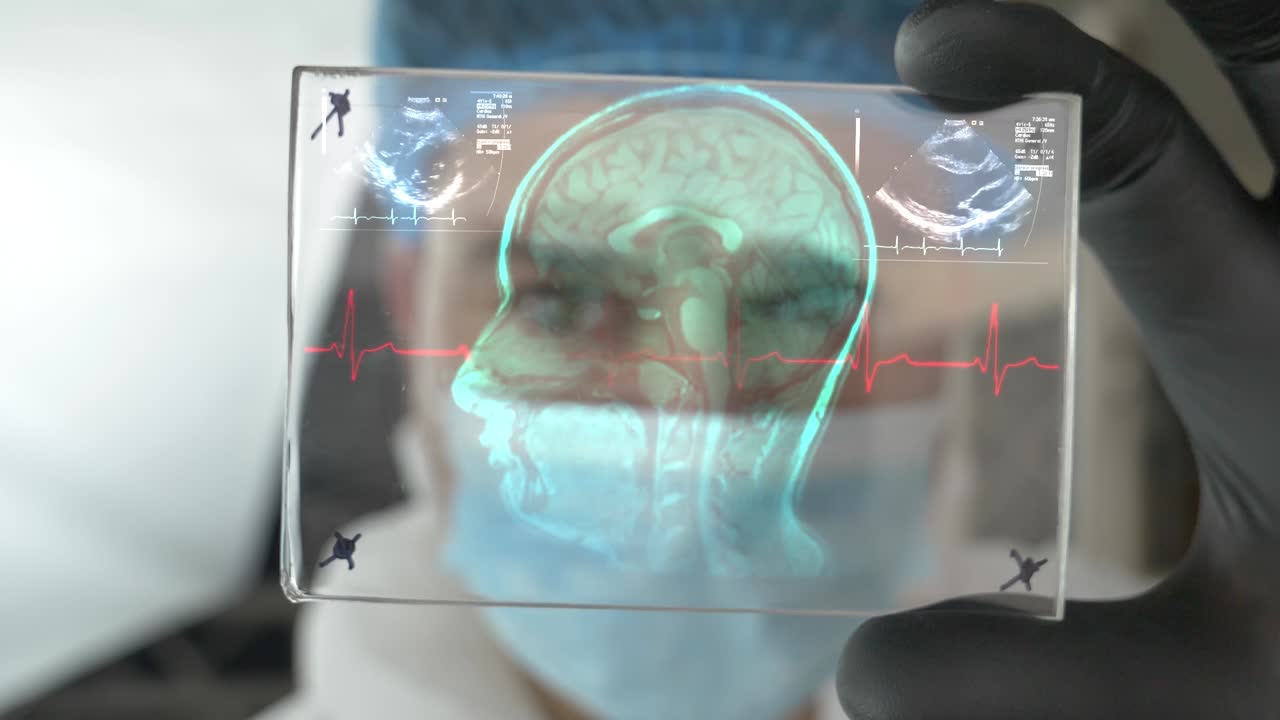 Medico tiene in mano una scansione TC cerebrale olografica futuristica per la diagnosi.