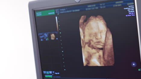 colorful images of a baby on the screen at sonography. monitor displays embryo of future child during ultrasound procedure of a pregnant woman.