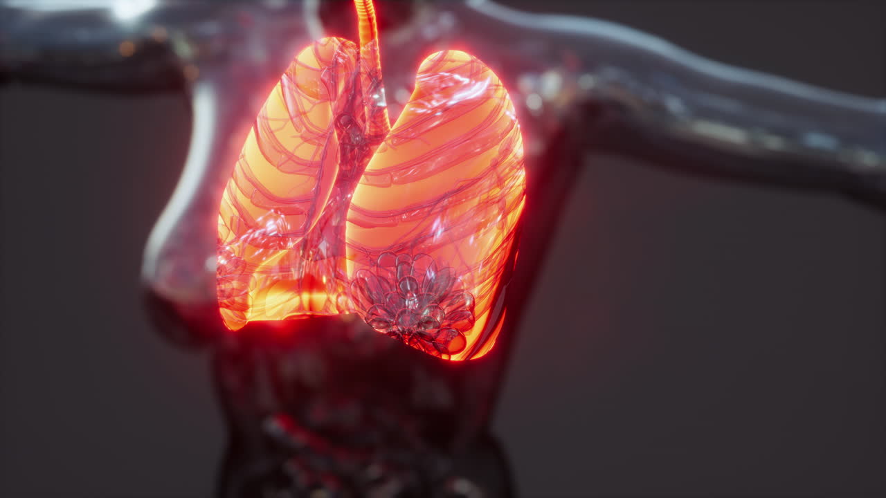 infección por coronavirus covid-19 en los pulmones