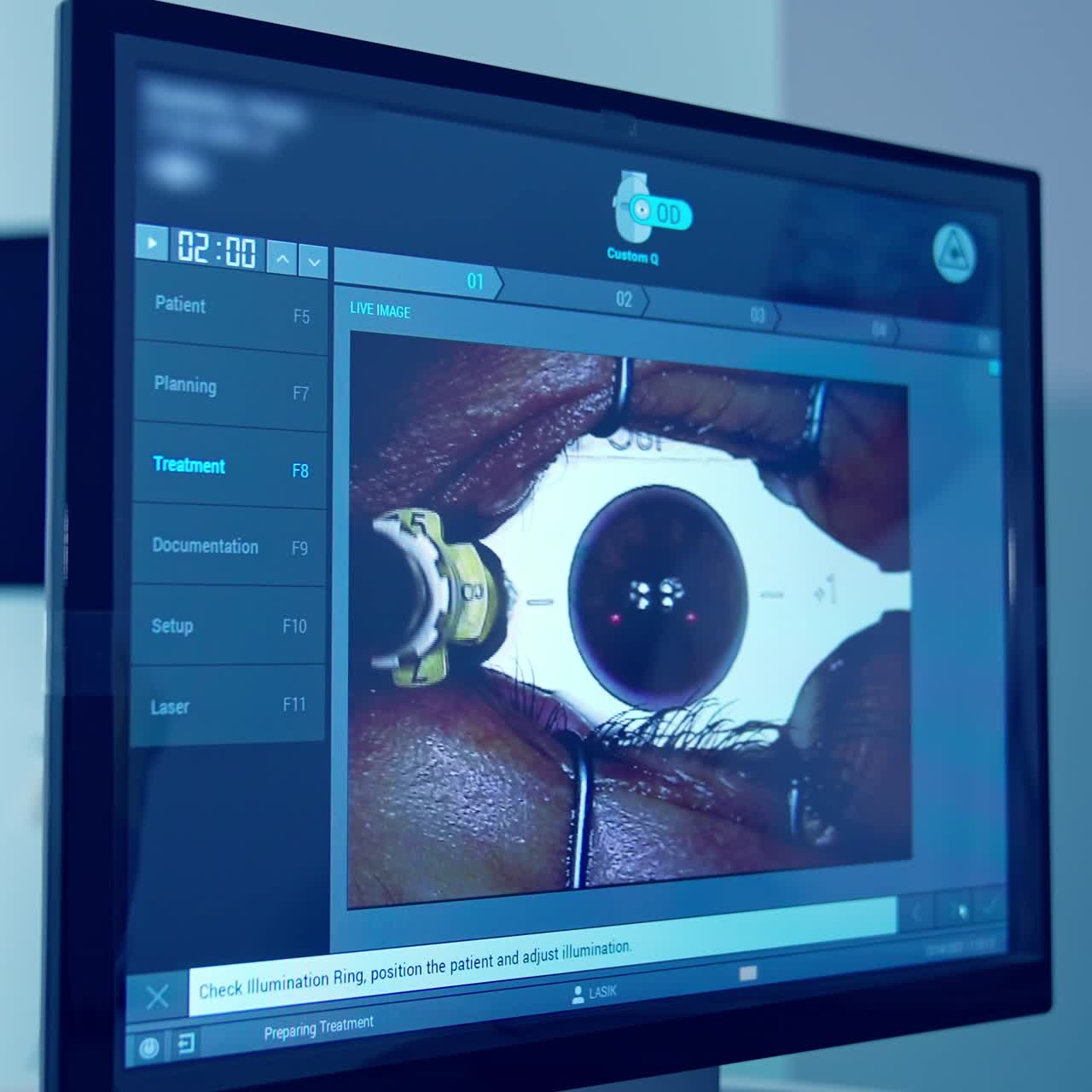 Surgeon performing operation on eye. Professional doctor during eye surgery in clinic