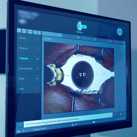 surgeon performing operation on eye. professional doctor during eye surgery in clinic