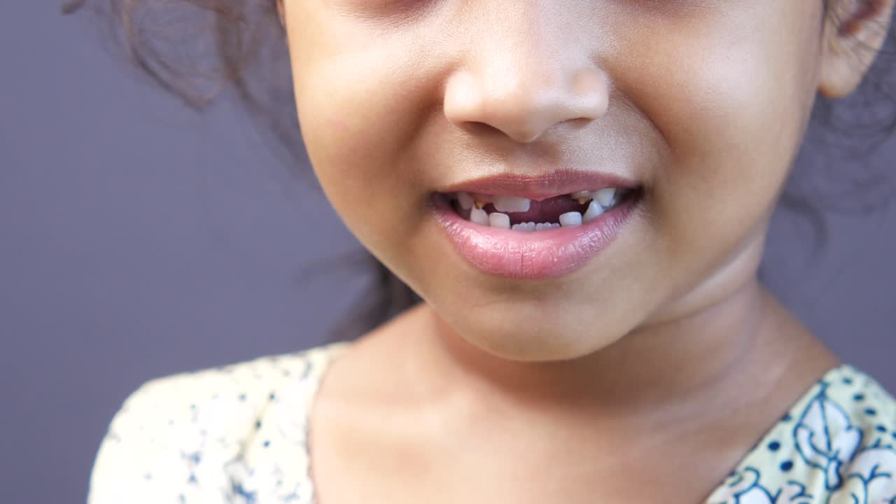 niño con dientes perdidos