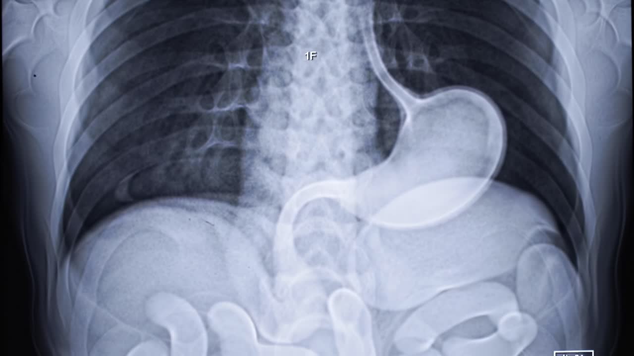 A clinical examination highlights stomach imaging, showcasing the structure and condition of the digestive system. The evaluation offers insights into potential health concerns.