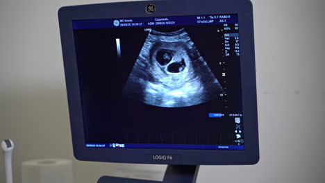 ultrasound procedure of human heart. doctor ultrasound examine patient at hospital