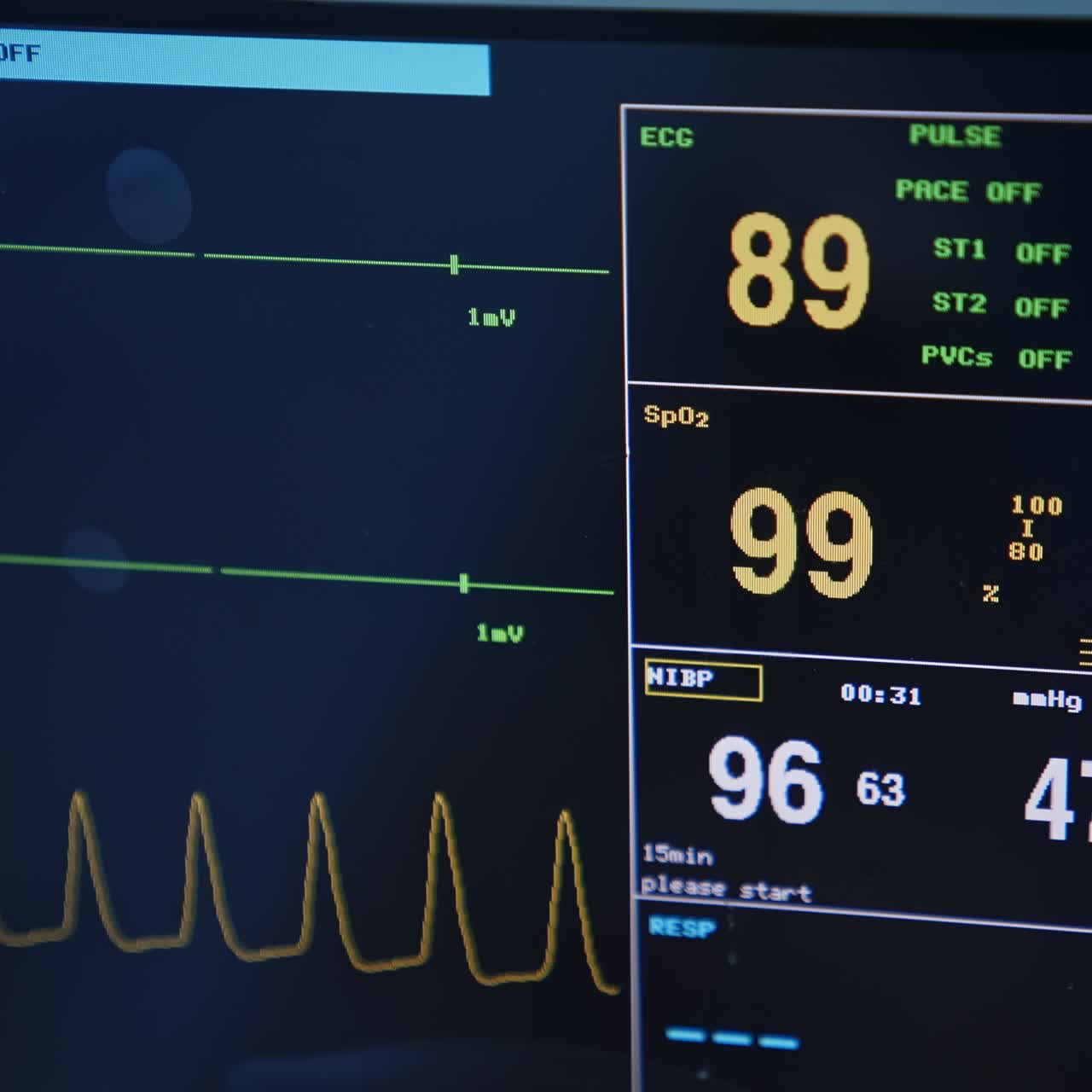 Pulse and heart rate parameters on the black screen. Life signs of a patient under the surgical procedure. Close up