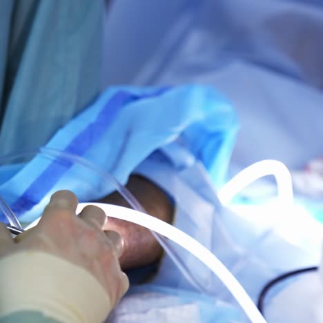 surgical procedure. doctor's hands in latex gloves conduct a surgery on patient's leg. surgeon uses surgical tools. close-up