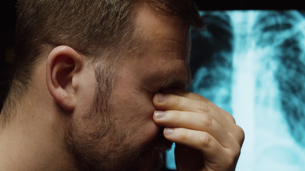 Uomo che si copre il viso in difficoltà con una radiografia polmonare sullo sfondo, concetto di diagnosi medica grave e malattia