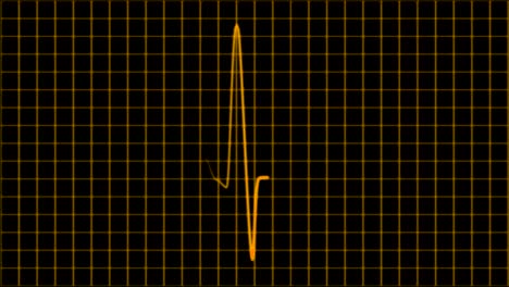 cardiograma, osciloscopio, bucle de la pantalla y