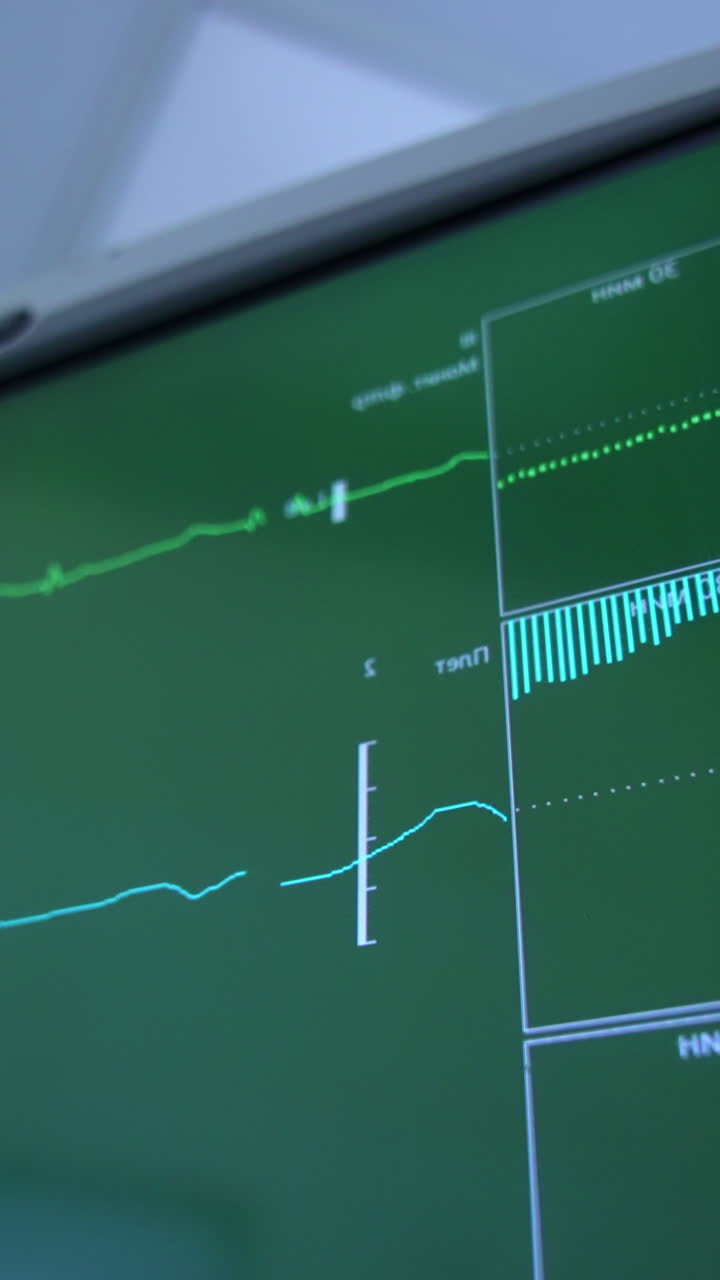 Two curved lines running on the green screen of equipment in surgery room. Close up. Low angle view. Blurred backdrop. Vertical video