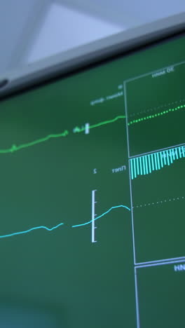 Two curved lines running on the green screen of equipment in surgery room. Close up. Low angle view. Blurred backdrop. Vertical video