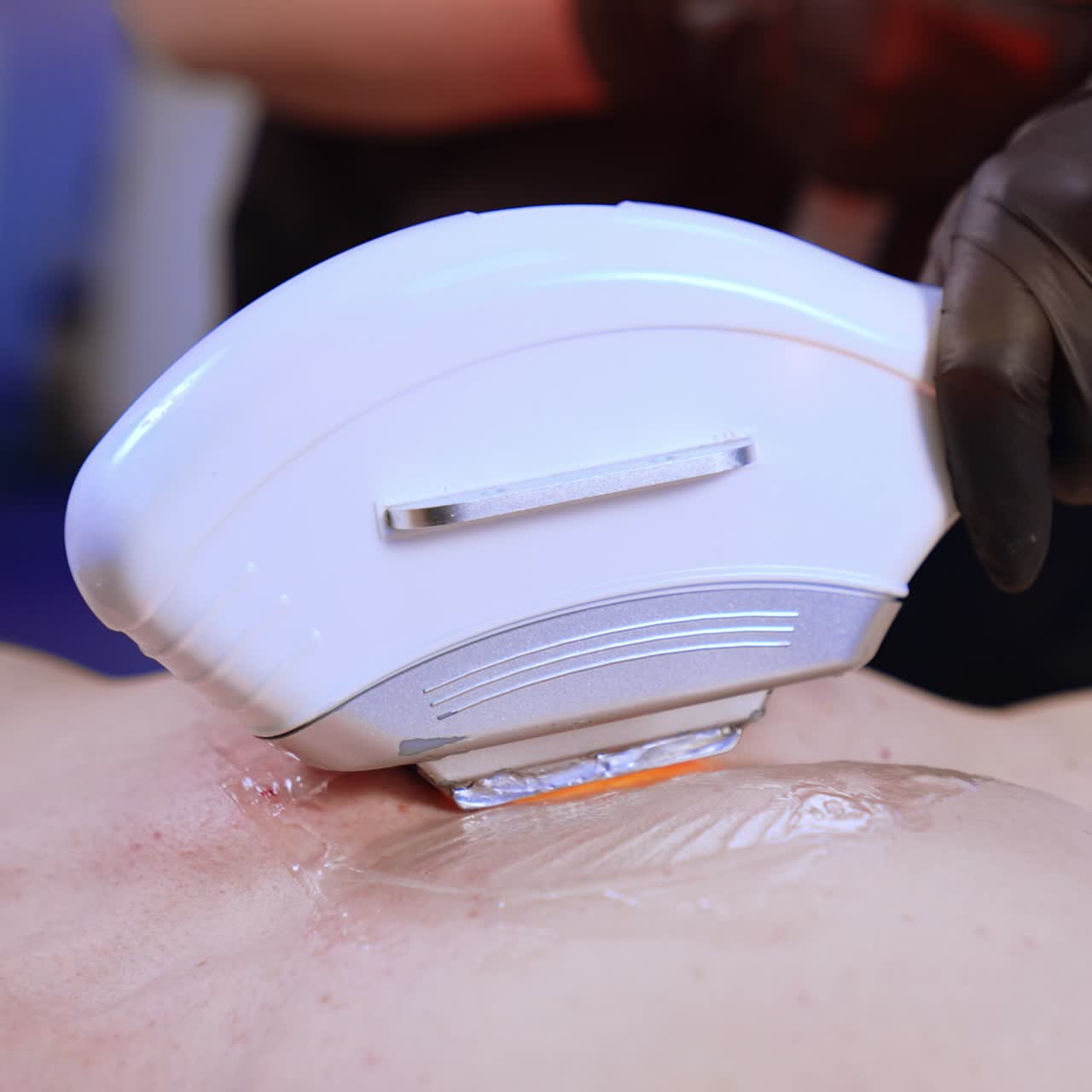 Modern laser equipment is moved by the male chest. Beauty specialist in black latex gloves removes hair. Close up