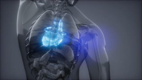 examen de radiología del corazón humano
