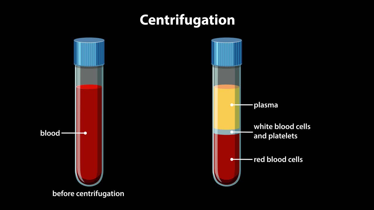Un diagramma didattico illustra la separazione del sangue in plasma, globuli bianchi e globuli rossi tramite centrifugazione.