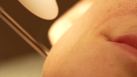 close-up-of-a-skin-treatment-involving-a-laser,-indicated-by-the-pinpoint-red-light-on-the-skin's-surface