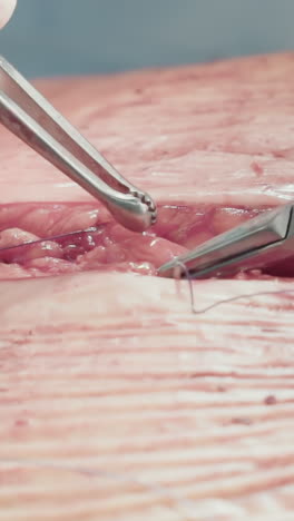 las manos del cirujano cosen la capa subcutánea. el médico experimentado utiliza instrumentos para cerrar cuidadosamente la incisión creando apoyo adicional con suturas