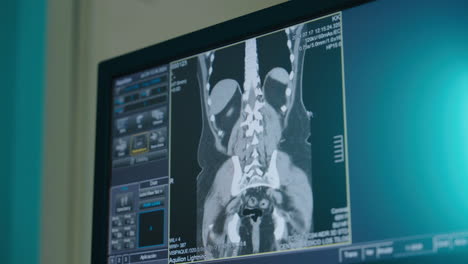 ct scan of the abdomen and thorax