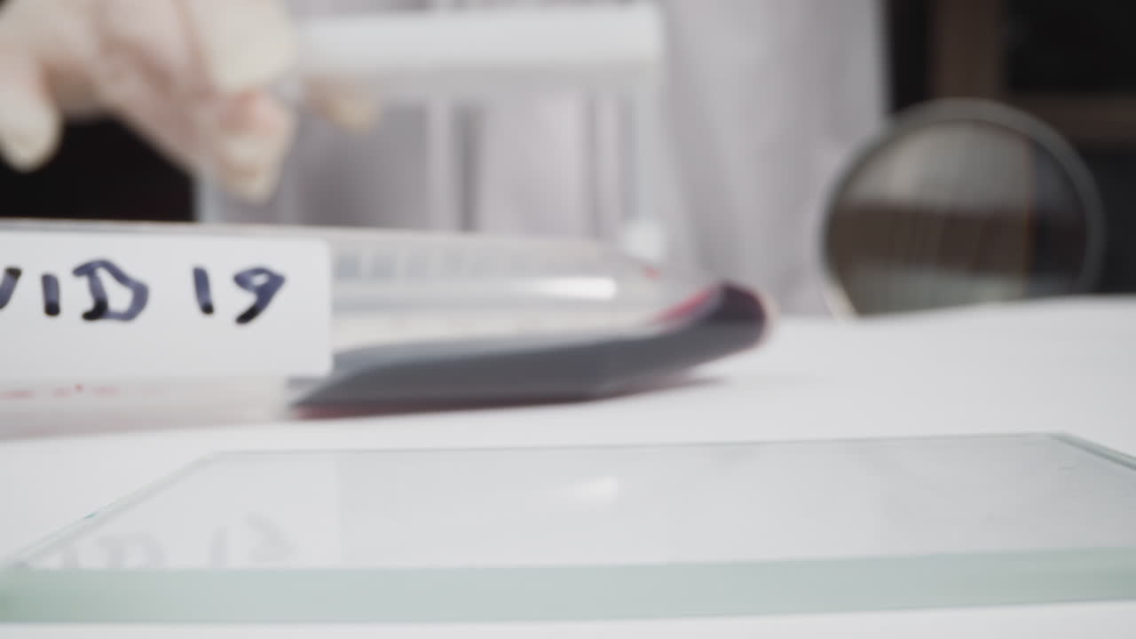 tubo con sangre y etiqueta covid en la mesa mujer trabajando en el laboratorio