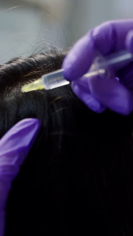 a beautiful young woman receives an injection in the head in the center of aesthetic medicine. prevention and treatment of hair growth vertical video