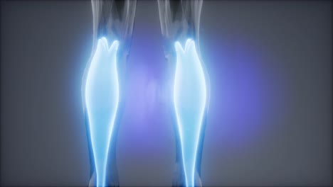 gastrocnemius- visible muscle anatomy map