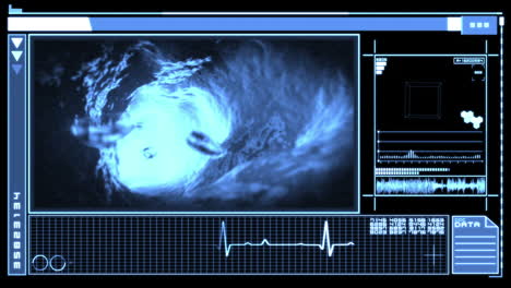 Digitale-Schnittstelle,-Die-Das-Durch-Eine-Vene-Fließende-Blut-Zeigt