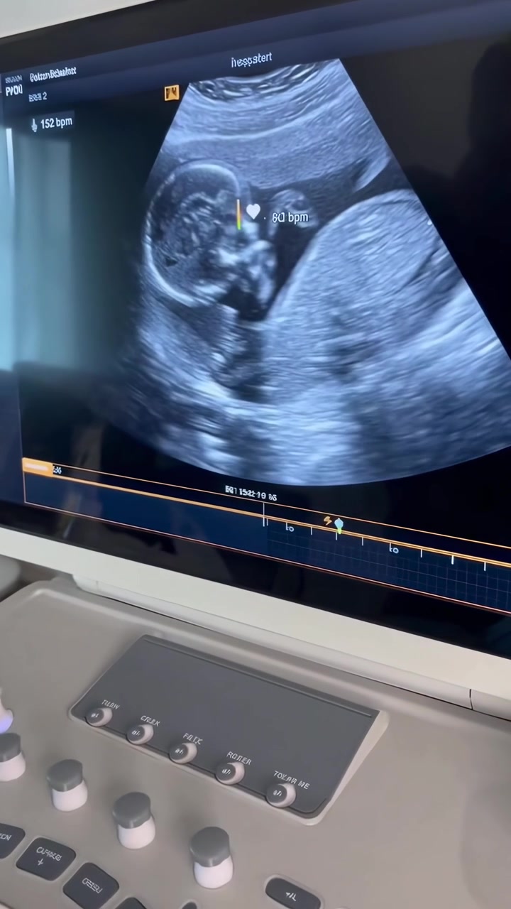 Ecografia medica di un feto nell'utero